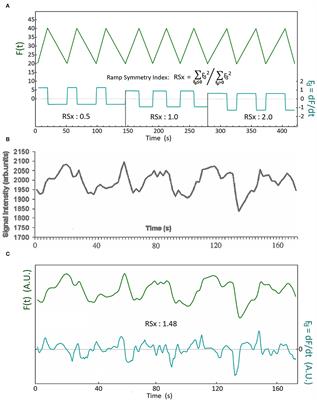 Physiological Mechanisms and Significance of Intracranial B Waves